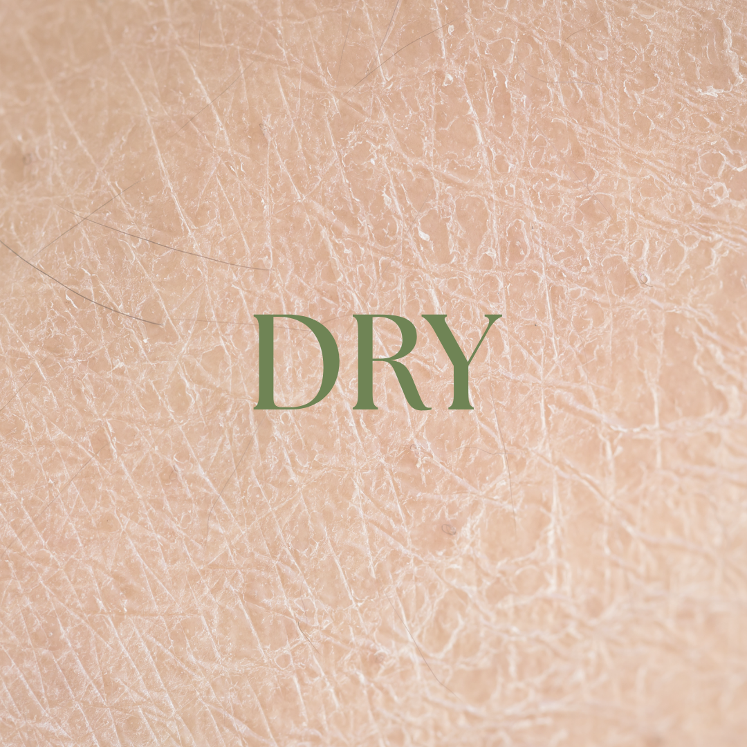 Dry Skin