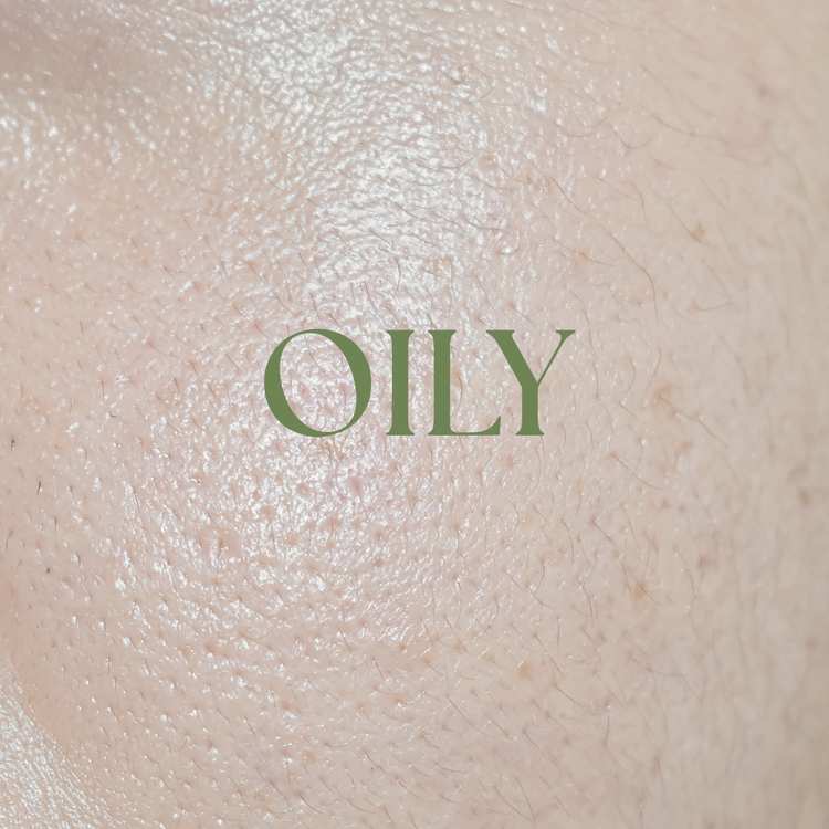 Oily Skin